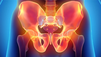 Pelvic Pain Relief